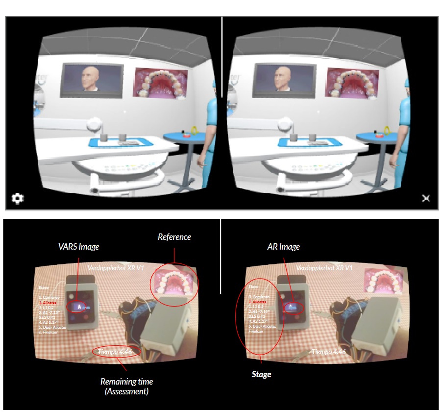 OptanAR orthodontics application